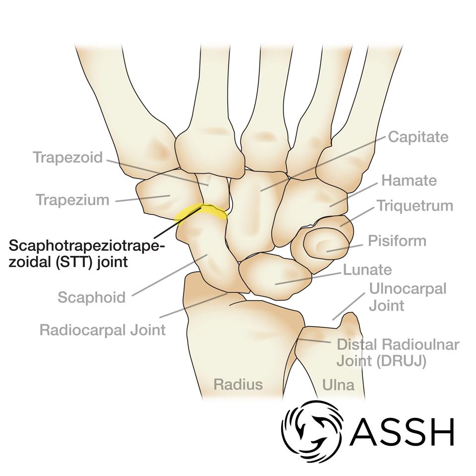 Hand Surgeon Blog Glenn D. Cohen, M.D.